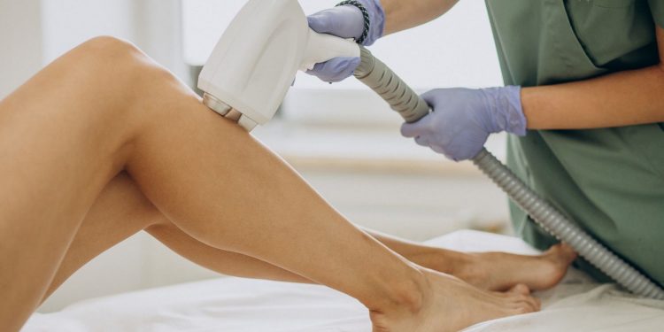 Unveiling Smooth Skin: A Comprehensive Guide to Laser Hair Removal