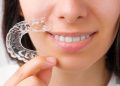 ParisAline Clear Aligners: Embracing the Smile of the Future