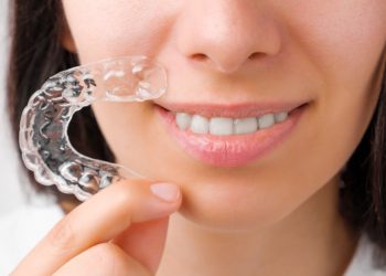 ParisAline Clear Aligners: Embracing the Smile of the Future