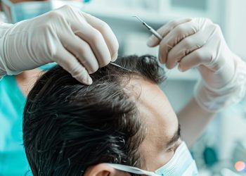 Understanding Your Hair Surgery Journey at Concord Hair Restoration, Los Angeles