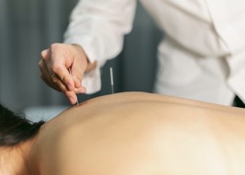 Top Acupuncture Spots for Effectively Managing Anxiety