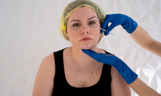 Lanluma in London: A Non-Surgical Way to Sculpt Your Chin, Jawline, Temples, and Cheeks