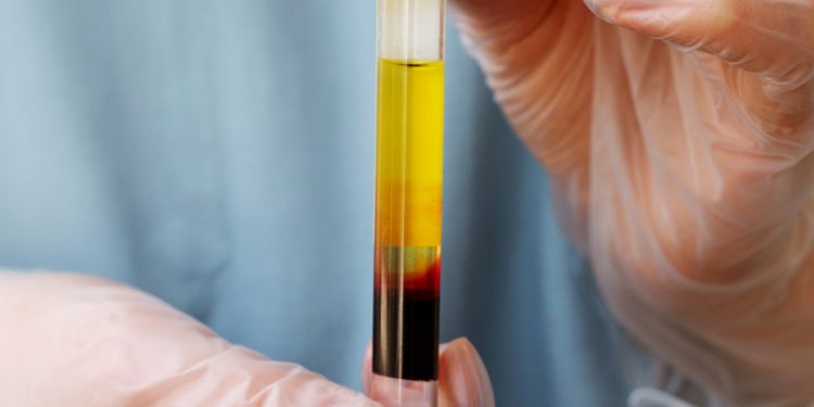 Does THCa Show Up on a Drug Test?